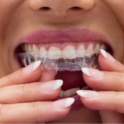 Invisalign